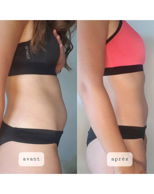 Gummies voor de spijsvertering - 30 gummies