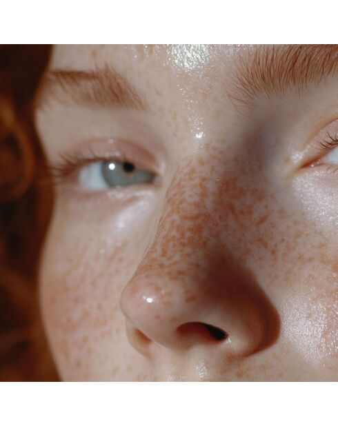 Gummies tegen roodheid - 30 gummies