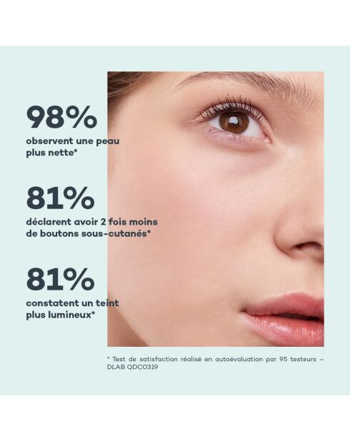 Skin Detox - Anti-Imperfektionen - 56 Kapseln