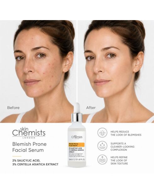 Gesichtsserum gegen Hautunreinheiten 30 ml mit 2% Salicylsäure, Centella Asiatica 30 ml