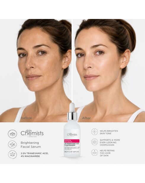 Aufhellendes Gesichtsserum mit 2,5% Tranexamsäure und 4% Niacinamid - 30 ml