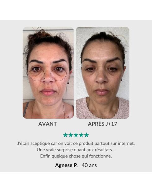 Soin intégral du regard : Stylo & Sérum activateur
