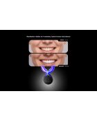 Unicled White Smile 5.0 LED-Zahnaufhellungsgerät